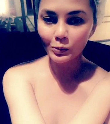 Chrissy Teigen leaked nude scandal